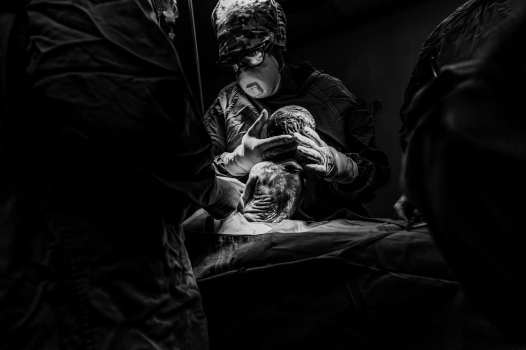 A Global Pandemic, a Caesarean, and a New Born Baby