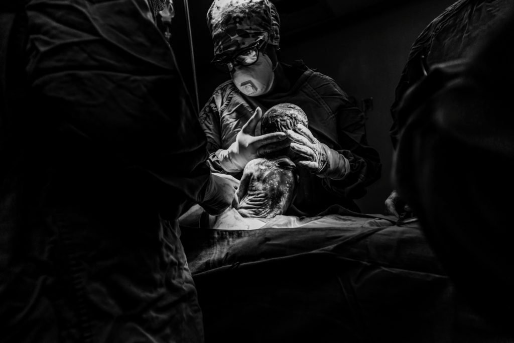 A Global Pandemic, a Caesarean, and a New Born Baby